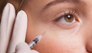 Botulinum toxin injections