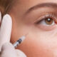 Botulinum toxin injections
