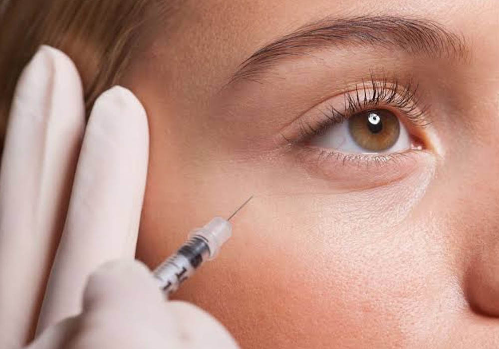 Botulinum toxin injections