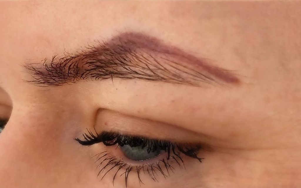 What to Expect From Cosmetic Tattoo Removal