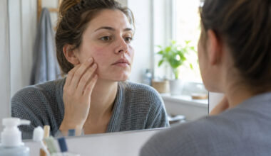 Skin Troubles Explained Common Problems and Their Causes