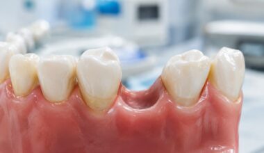 How Rockville MD Residents Can Compare Tooth Replacement Options Before Making a Long Term Decision